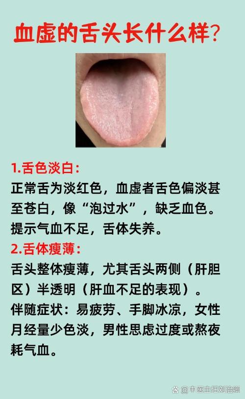 血之根源更新地址如何获取？官网入口及渠道推荐一览！